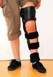 Vier-Band-Rekonstruktion bei traumatischer Luxation des Kniegelenkes; orthetische Versorgung mittels PCL-Version.