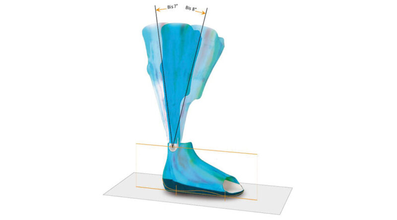 Unilaterale Acryl-Carbon-Orthese mit Sprinter Knöchelgelenk. Das Be­we­gungsausmaß ist zwischen 7° PF und 8° DE beschränkt.