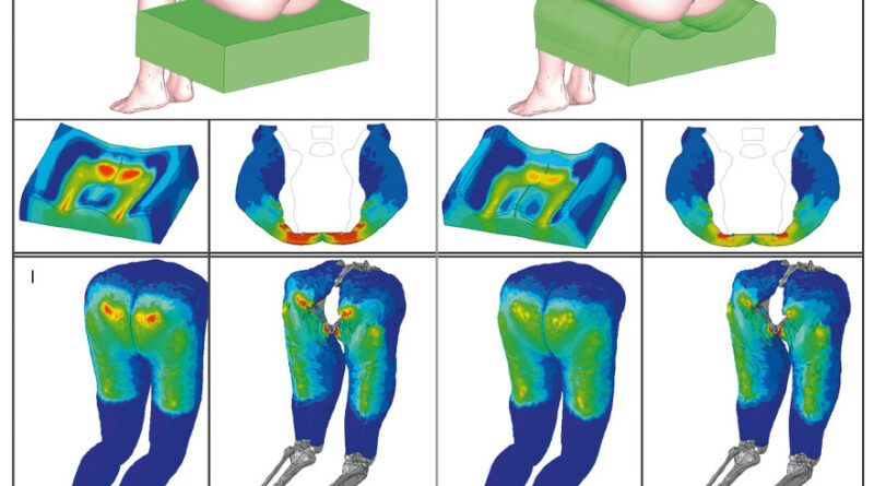 Vergleich der Normalspannungsverteilungen an der Hautoberfläche und am Fett-Muskel-Übergang eines männlichen BOSS-Modells für ein quaderförmiges Sitzkissen (links) und die formoptimierte Variante (rechts).