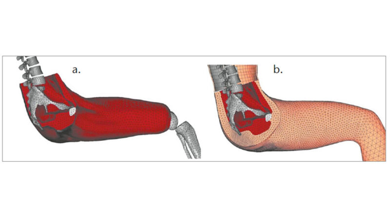 Details der Gluteus- und Oberschenkelanatomie des in Abbildung 2 dargestellten Menschmodells.