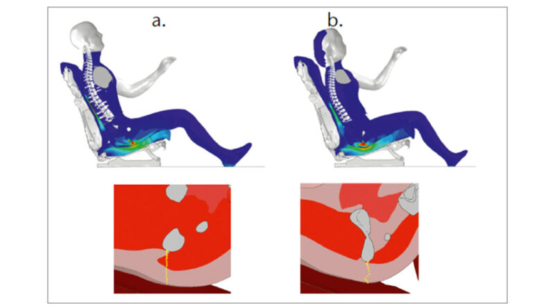 Spannungsverteilungen in der Sagittalebene der Sitz­höckerregion a. eines männlichen und b. eines weiblichen sitzenden BOSS-Modells (jeweils oben) und die Lage der (gelb gekennzeichneten) Knotenpfade (jeweils unten).