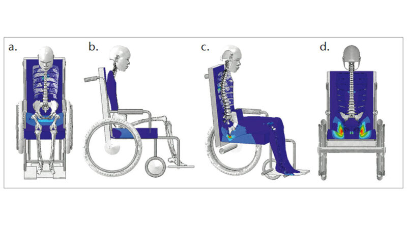 Prinzipielle Situation bei der Interaktion eines Menschen mit einem Sitzkissen im Rollstuhl, a. und b. Skelett in Vorder- und Seitenansicht, c. Normalspannungsverteilungen in der Sagittalebene und d. Scherverzerrungen im Weichgewebe der Sitzhöckerregion in der Frontalebene.