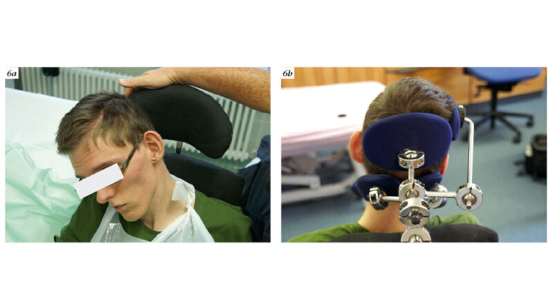 6a: fehlende Kopfkontrolle; 6b: individuelle Abstützung, die dem Patienten eine verbesserte Kommunikation ermöglicht.