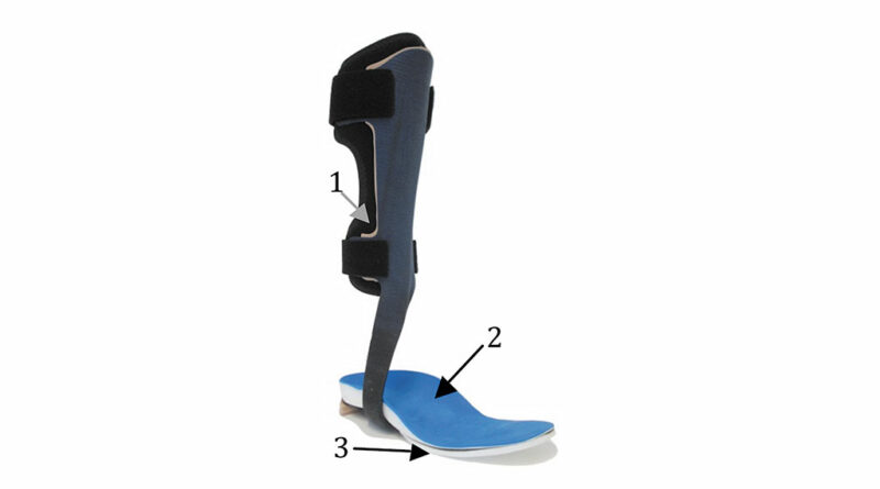 Beispiel einer Blue Rocker-Orthese mit individuellen Modifikationen: 1 = Polsterung (Soft-Kit + individuelles Polster), 2 = individuelles Fußbett nach Gipsabdruck, 3 = Ausgleichskeil.