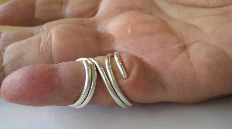 Ringversorgung in Silber mit großflächiger Anlage zur Korrektur und Stabilisierung.