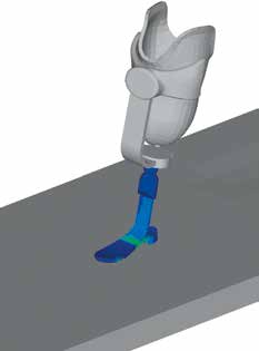In der Prothese auftretende dynamische Spannungen. Die in die Simulation einfließenden Bewegungsdaten führen im Knöchel-Fuß-Passteil zu mechanischen Spannungen.