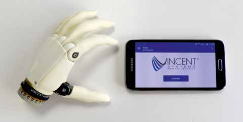 Smartphone-Anwendung zum individuellen Einstellen und Trainieren der Prothesenparameter.