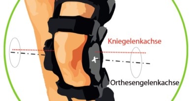 Inkongruenz von Knie- und Orthesengelenkachse bei einer üblichen Knieorthese.