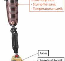 Prinzipdarstellung einer Prothese mit Temperaturregulierung durch die Integration von textiler Temperatursensorik und textiler Heizstruktur.