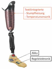 Prinzipdarstellung einer Prothese mit Temperaturregulierung durch die Integration von textiler Temperatursensorik und textiler Heizstruktur.
