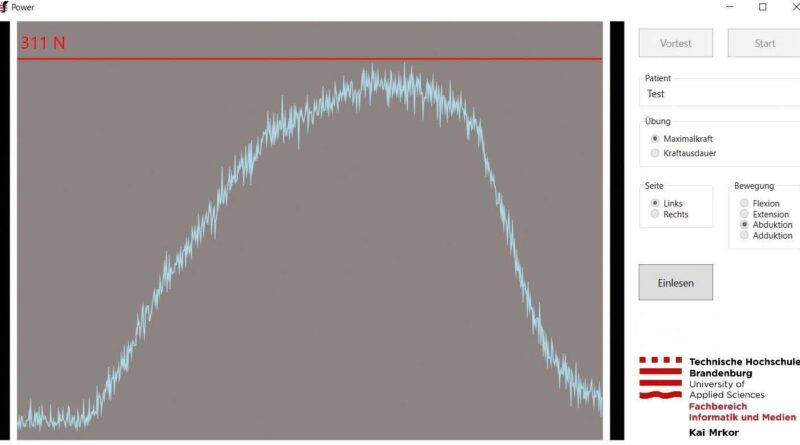Messvorgang mit dem Diagnostikgerät: b) Bildschirmdarstellung des Kraftmoduls der Diagnostiksoftware mit Darstellung der Kraftkurve der isometrischen Maximalkrafttestung in die Hüftabduktion.