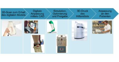 SIGMA3D – Simulationsgestützte Medizintechnikplattform zur individuellen 3D-Hilfsmittelversorgung