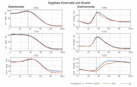 Sagittale Kinetik und Kinematik beim STS, Beispieldaten für einen Probanden.