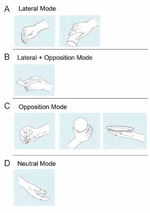 Verschiedene Handpositionen, die mithilfe der 3 unterschiedlichen Daumenpositionen „Opposition", „lateral" und „neutral" mit der Michelangelo Hand realisiert werden können.