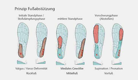 Abstützung des Fußes von dorsal nach ventral bei den verschiedenen Deformitäten.