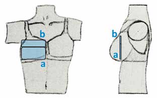 Lokalisation der Drucksensormatten zwischen Haut und Prothese bzw. BH-Tasche: (a) größere Sensormatte (6 x 15 Sensoren), anliegend am unteren Ende des Büstenhalters; (b) kleinere Sensormatte (3 x 15 Sensoren) bündig zur größeren Sensormatte.