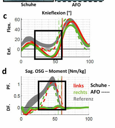 Patient A: Effekte der rigiden AFO im Vergleich mit Schuhen in der 3D-Ganganalyse; a) Standphase rechts mit Schuhen vs. b) Schuhe + Orthese; c) Knieflexionswinkel; d) Gelenkmomente des Oberen Sprunggelenks (OSG); e) OSG-Gelenkleistung.
