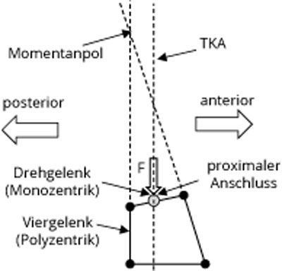 Schematische Darstellung und Lage der Mono- und der Polyzentrik des „VarioKnies“.