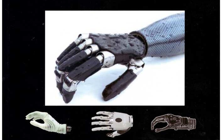 Anwender-Trainingsprogramm für Vincent Evolution/Vincent Systems und andere Elektrohände – Mit einer Roboterhand zurück ins Leben