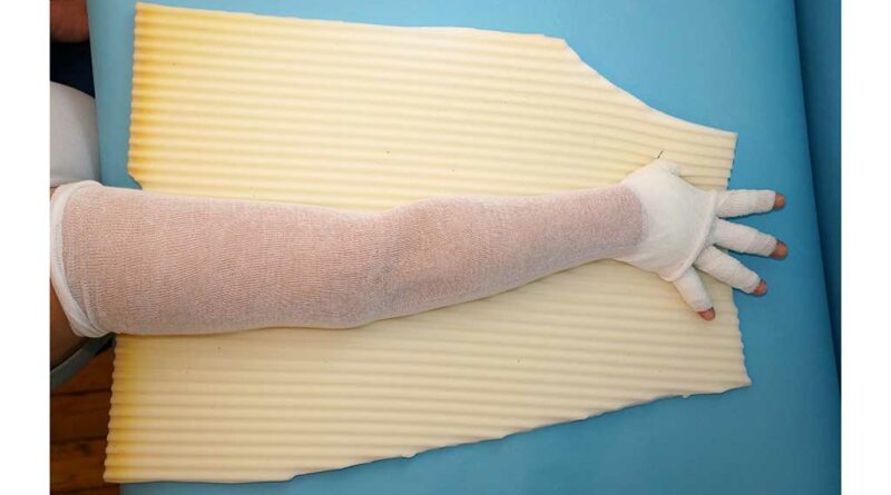 Bandage mit unruhiger Polsterung; Fingerbandage (Mittelzugbinde), Baumwollstrumpf, zugeschnittene unruhige Polsterung mit Lamellenschaumstoff.