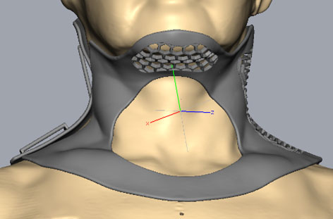 Details der entworfenen virtuellen Zervikalorthese per „Geomagic Freeform“; Ansicht von frontal mit Kehlkopfaussparung.