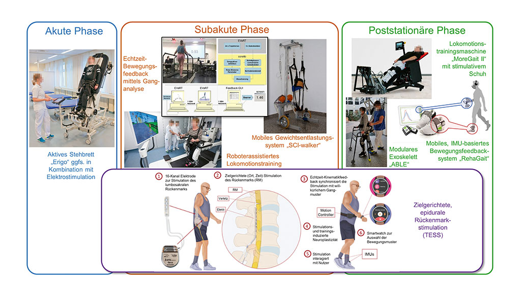 Technische Assistenzsysteme Für Die Motorische Rehabilitation Von ...