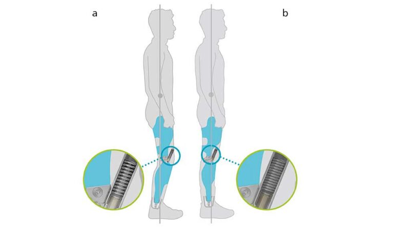 Biomechanischer Nutzen des dynamischen EA im Stehen; a) Grundaufbau in leichter Knieflexion; b) Kniesicherung durch physiologische Hyperextension gegen den Widerstand der ventralen Federeinheit.