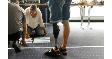 Orthopädietechniker-Meisterin (OTM) Kristin Stahl versorgt Menschen nach Amputationen mit der von ihr entwickelten MCT-Liner-Technik. Dafür werden mit und ohne die Technik entstandene Abdrücke überprüft.