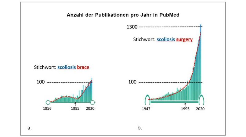 Anzahl der wissenschaftlichen Publikationen zwischen 1956 und 2021 im Verhältnis von Korsett zu Operation bei Skoliose (größenadaptierte Darstellung) mit einem Ergebnis von ca. 1 zu 10; a) Stichwort „scoliosis brace“; b) Stichwort „scoliosis surgery“.