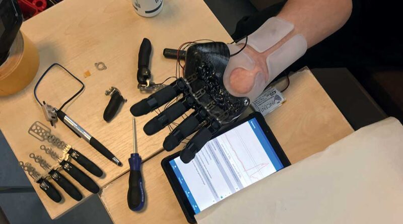 Der Patient probiert einen Testschaft der myoelektrischen Armprothese in der Werkstatt an.