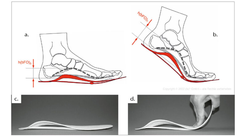 Bionische Fußorthese in Aktion, schematisch und realiter – mittlere (a u. c) und späte Standphase (b u. d); a) Stabilisierung bzw. Unterstützung der Höhe des Mittel- und Rückfußes während der mittleren Standphase (h(bFO)0) beim Gehen; b) Unterstützung des Anhebens des medialen Bogens und der Supination (h(bFO)1 > h(bFO)0) während der Vorfußbelastung mit dorsalextendierten Zehen in der späten Standphase; c) mediolaterale Ansicht der 3D-gedruckten bionischen Fußorthese; d) bionische Fußorthese mit dorsalextendiertem Vorfußbereich und daraus resultierend konvex angehobener Deckschicht im Mittel- und Rückfußbereich.