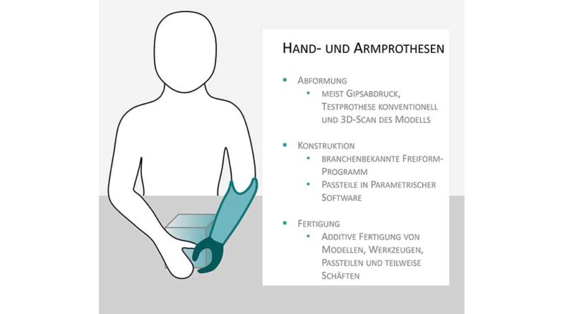 Hand- und Armprothesen.