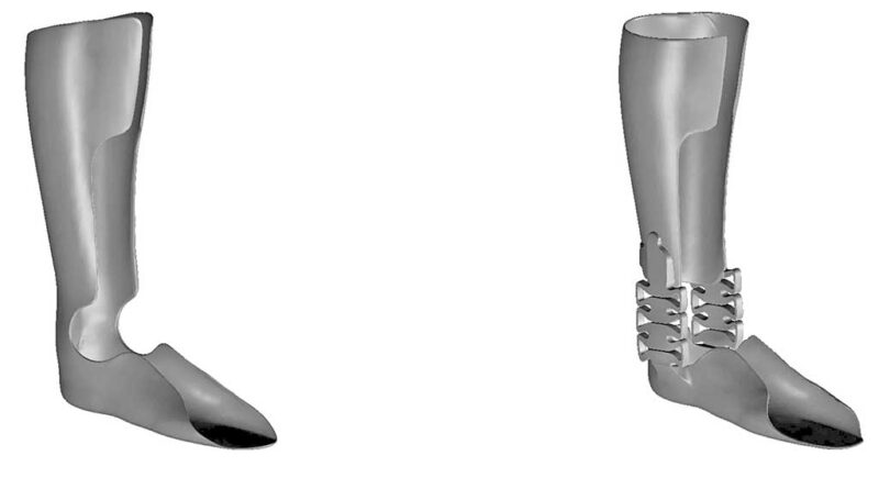 Traditionell (ORD) (links) und additiv gefertigte Unterschenkelorthese (rechts) im CAD.