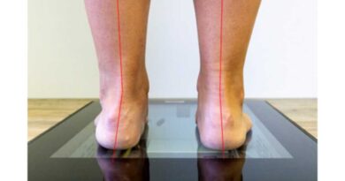 Achsab­weichungen an der Basis ­stehen oft in einem komplexen Zusammenhang, der bei der Konzeption von physiologisch-funktionalen dynamischen Fußorthesen berücksichtigt werden muss; Fußstellung.