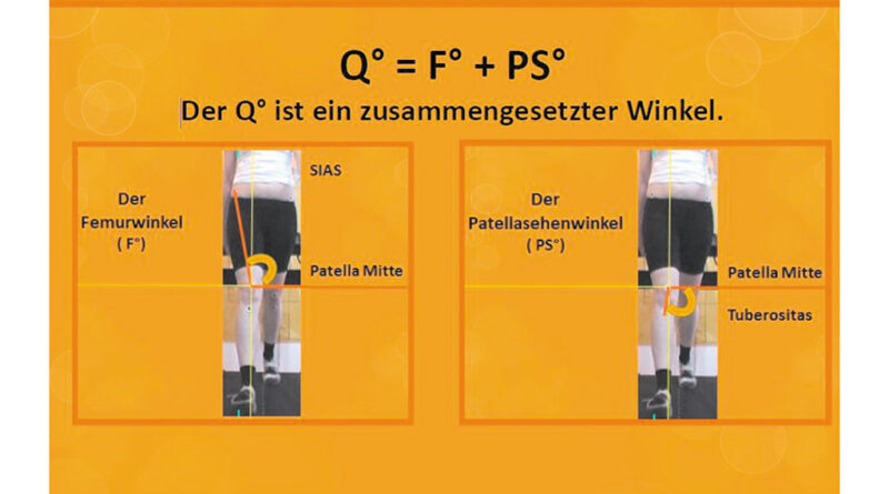 Q-Winkel (Quelle: Molitor, Vortrag Kniekonzept).