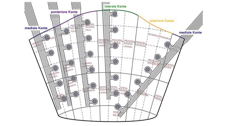 Konfiguration des Drucksensors auf der Karte des Stumpfes des Probanden für Test 1.