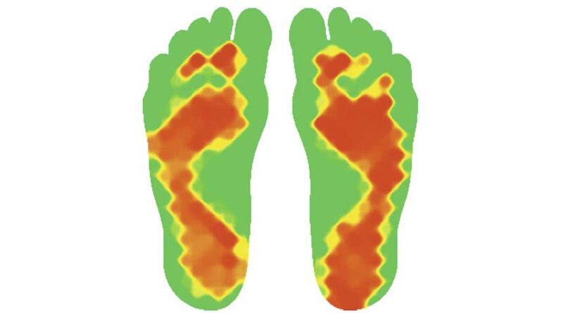 Darstellung der Wärmeverteilung nach der podologischen Behandlung von Risikopatientin MP-089 – die Füße sind gleichmäßig erwärmt und durchblutet.