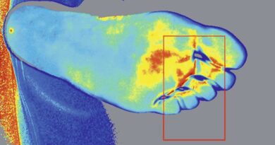 Falschfarbendarstellung eines Fußes mit Hilfe einer Laser-Doppler-Aufnahme.
