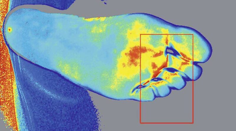 Falschfarbendarstellung eines Fußes mit Hilfe einer Laser-Doppler-Aufnahme.