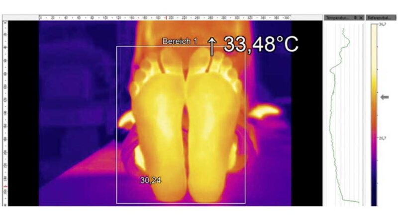 Aufnahme der Fußtemperatur bei einem gesunden Menschen mit Hilfe einer Wärmebildkamera.