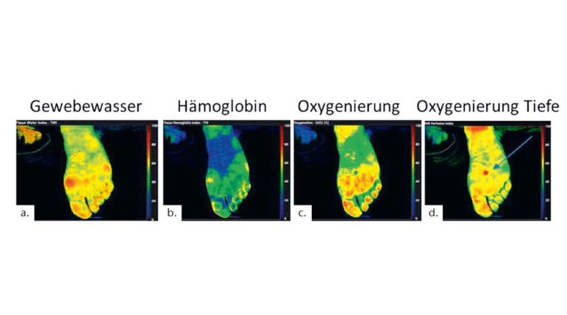 Hyperspektral-Imaging zur Messung der Sauerstoffsättigung in Blut und Gewebe.
