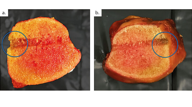 Geschädigter Knochen (blauer Kreis), a) proximale Tibia, Schädigung ­auf ­medialer Seite, b) distale Tibia (Farben angepasst).