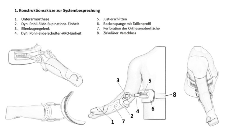 Erste Konstruktionsskizze/Rohentwurf zur Concept-4D-Orthese nach Pohlig/Bahm.