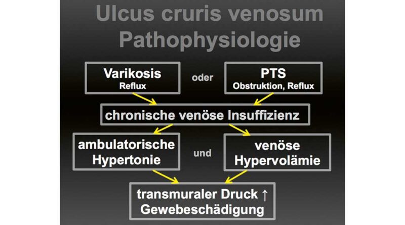 Pathophysiologie des Ulcus cruris venosum