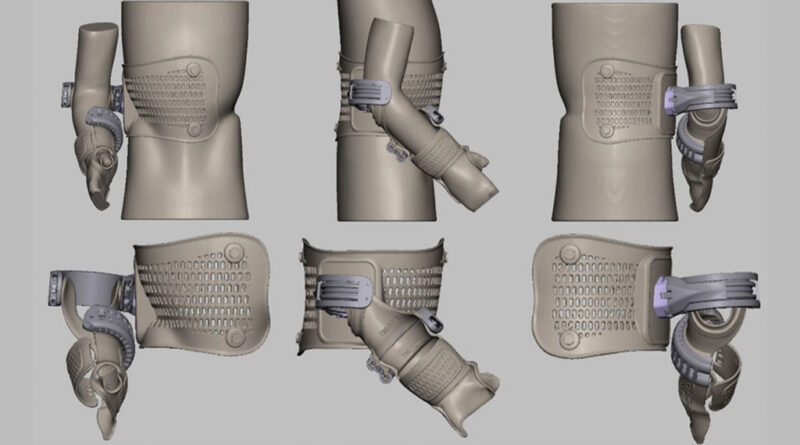 Digitale Konstruktion der Concept-4D-Orthese.