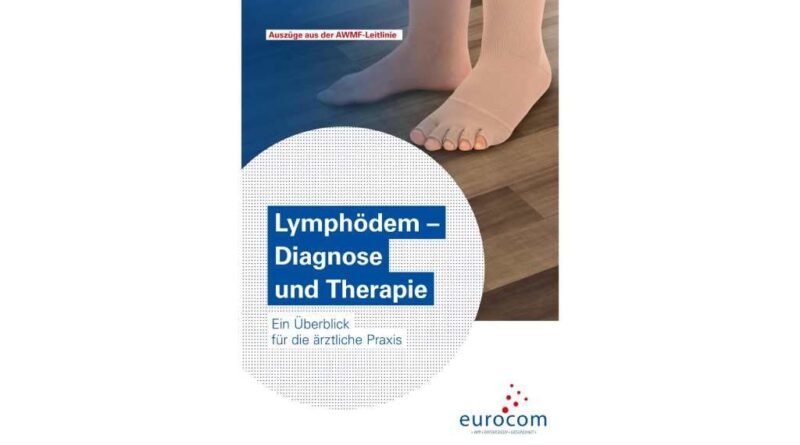 Mit „Lymphödem – Diagnose und Therapie“ gibt die Eurocom einen Überblick über die Hintergründe der Erkrankung und Behandlungsmöglichkeiten.