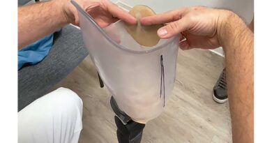 <img class="new_ribbon" width="25" height="25" src="https://360-ot.de/wp-content/uploads/2020/01/pluslogo.png">Pass­form­kon­trol­le bei Ober- und Unterschenkelprothesen