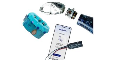 Myoelektrische Prothesenhand speedhand von Ottobock.