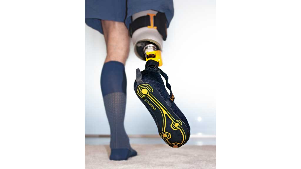 Die Linderung von Phantomschmerzen ist als Nebeneffekt des Einsatzes des Suralis-Systems festgestellt worden. Eine Studie soll dies nun bestätigen. Foto: Reboocon Bionics