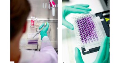 Abb. 1a u. b Im Zytotoxizitätstest nach DIN EN ISO 10993-5 kommt die BCA-Proteinfärbung zum Einsatz, um den Gesamtproteingehalt kultivierter Zellen zu ermitteln. Der gemessene Proteingehalt dient dabei als indirektes Maß für die Zellzahl und ermöglicht eine Bewertung der Zellviabilität nach Kontakt mit dem Prüfmaterial. Pipettieren des Zytotoxizitätstest unter der Sterilwerkbank (a); Auswertung des Zytotoxizitätstest mittels Photometer (b).